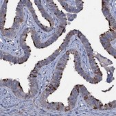 Anti-WDR66 antibody produced in rabbit Prestige Antibodies® Powered by Atlas Antibodies, affinity isolated antibody, buffered aqueous glycerol solution