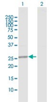 Anti-GAMT antibody produced in rabbit purified immunoglobulin, buffered aqueous solution