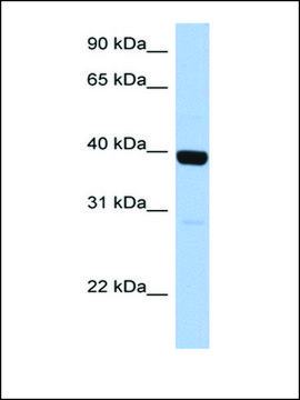 Anti-ZNF385B antibody produced in rabbit affinity isolated antibody