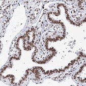 Anti-QRICH1 antibody produced in rabbit affinity isolated antibody, buffered aqueous glycerol solution