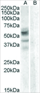 Anti-Arylsulfatase D antibody produced in goat affinity isolated antibody, buffered aqueous solution