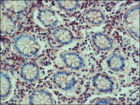 Anti-Bak antibody produced in rabbit IgG fraction of antiserum, buffered aqueous solution