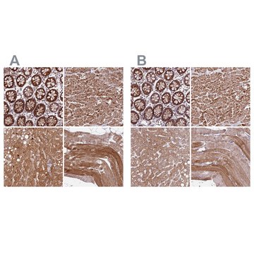 Anti-NDUFA8 antibody produced in rabbit Prestige Antibodies&#174; Powered by Atlas Antibodies, affinity isolated antibody, buffered aqueous glycerol solution