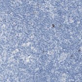 Anti-LAG3 antibody produced in rabbit Prestige Antibodies® Powered by Atlas Antibodies, affinity isolated antibody, buffered aqueous glycerol solution
