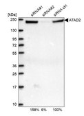 Anti-ATAD2 antibody produced in rabbit Prestige Antibodies® Powered by Atlas Antibodies, affinity isolated antibody, buffered aqueous glycerol solution