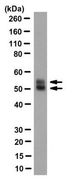 Anti-Herpes Simplex Virus Glycoprotein D Antibody, clone LP14 clone LP14, from mouse