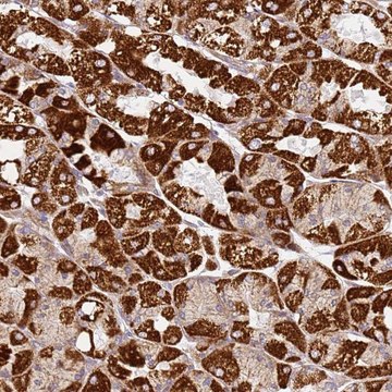 Anti-TMEM200C antibody produced in rabbit Prestige Antibodies&#174; Powered by Atlas Antibodies, affinity isolated antibody, buffered aqueous glycerol solution