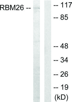 Anti-RBM26 antibody produced in rabbit affinity isolated antibody