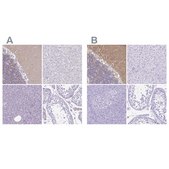 Anti-SYT1 antibody produced in rabbit Prestige Antibodies® Powered by Atlas Antibodies, affinity isolated antibody, buffered aqueous glycerol solution