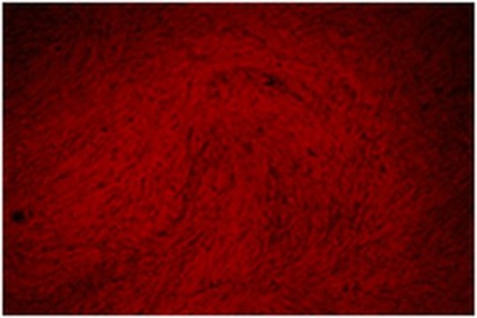 Alizarin-Red Staining Solution Alizarin red is a commonly used stain to identify calcium containing osteocytes in differentiated culture of both human and rodent mesenchymal stem cells (MSCs).