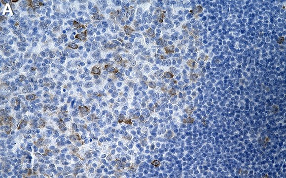 Anti-RRM1 Antibody, clone 1E20 ZooMAb&#174; Rabbit Monoclonal recombinant, expressed in HEK 293 cells