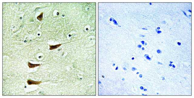 Anti-MAP3K10 antibody produced in rabbit affinity isolated antibody