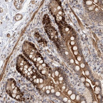 Anti-PIK3C2A antibody produced in rabbit Prestige Antibodies&#174; Powered by Atlas Antibodies, affinity isolated antibody, buffered aqueous glycerol solution