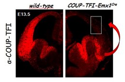 Anti-COUP-TF1 Antibody serum, from rabbit