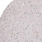 Anti-KLHL24 antibody produced in rabbit Prestige Antibodies® Powered by Atlas Antibodies, affinity isolated antibody, buffered aqueous glycerol solution