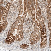 Anti-LLGL2 antibody produced in rabbit Prestige Antibodies® Powered by Atlas Antibodies, affinity isolated antibody, buffered aqueous glycerol solution