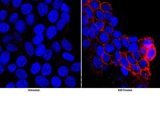 Anti-phospho-EGFR (Tyr1069) Antibody from rabbit, purified by affinity chromatography