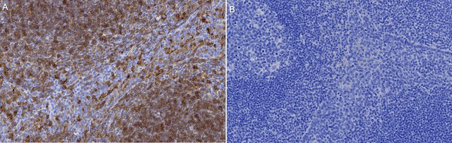 Anti-HLA-DRB1 Antibody, clone 4D12 ZooMAb&#174; Rabbit Monoclonal recombinant, expressed in HEK 293 cells