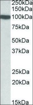 Anti-DNMT3A antibody produced in goat affinity isolated antibody, buffered aqueous solution