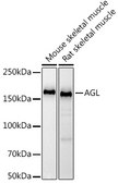 Anti-AGL Antibody, clone 8V9K5, Rabbit Monoclonal