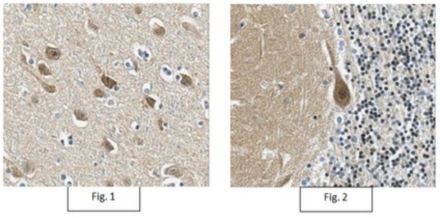 Anti-CRTC1 Antibody/TORC-1, clone 5F3.1 clone 5F3.1, from mouse