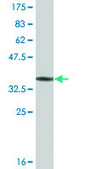 Monoclonal Anti-CABC1 antibody produced in mouse clone 1C12, ascites fluid