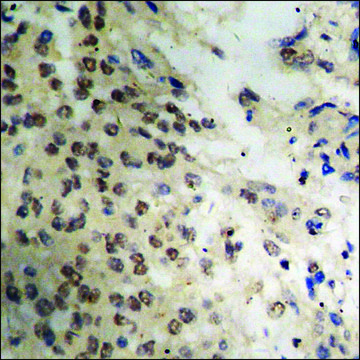 Anti-phospho-DAPK3 (pThr265) antibody produced in rabbit affinity isolated antibody