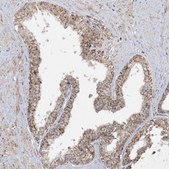 Anti-NDUFAF3 antibody produced in rabbit Prestige Antibodies&#174; Powered by Atlas Antibodies, affinity isolated antibody, buffered aqueous glycerol solution