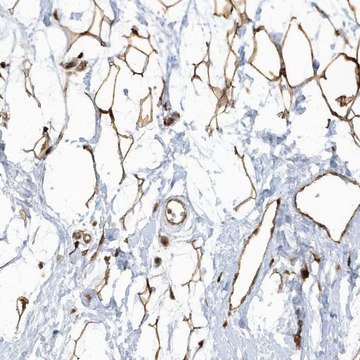 Anti-ECM2 antibody produced in rabbit Prestige Antibodies&#174; Powered by Atlas Antibodies, affinity isolated antibody, buffered aqueous glycerol solution