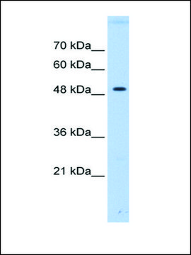 Anti-PTPN1 antibody produced in rabbit affinity isolated antibody