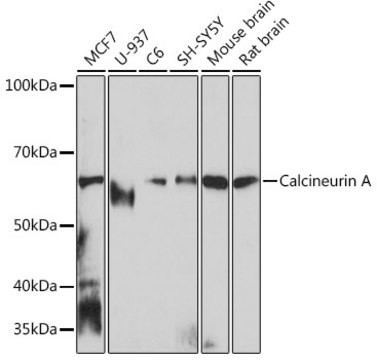 Anti-Calcineurin A Antibody, clone 5I6H8, Rabbit Monoclonal