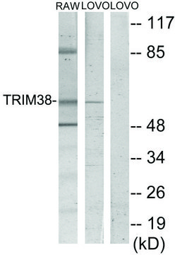 Anti-TRIM38 antibody produced in rabbit affinity isolated antibody