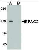 Anti-RAPGEF4 antibody produced in rabbit affinity isolated antibody