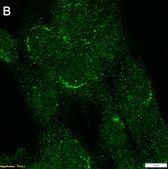 Anti-LRBA Antibody, clone 3H22 ZooMAb® Rabbit Monoclonal recombinant, expressed in HEK 293 cells