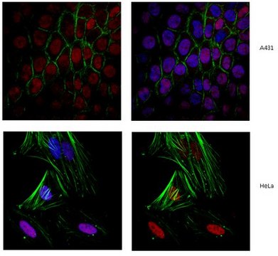 Anti-Cohesin subunit SA-2 Antibody from rabbit, purified by affinity chromatography