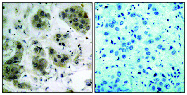 Anti-AKT antibody produced in rabbit affinity isolated antibody