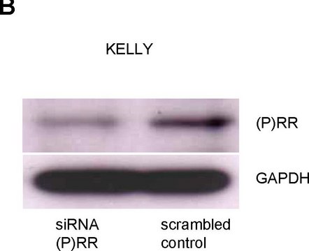 抗-ATP6AP2 兔抗 affinity isolated antibody, buffered aqueous glycerol solution