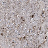 Anti-FAM210A antibody produced in rabbit Prestige Antibodies® Powered by Atlas Antibodies, affinity isolated antibody, buffered aqueous glycerol solution