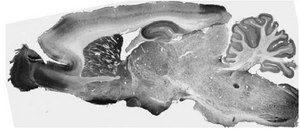 Anti-pan Thyroid Hormone Receptor Antibody, clone N403/63 clone N403/63, from mouse