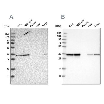 Anti-PPA1 antibody produced in rabbit Prestige Antibodies&#174; Powered by Atlas Antibodies, affinity isolated antibody, buffered aqueous glycerol solution, Ab2