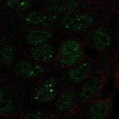 Anti-SNRPA1 antibody produced in rabbit Prestige Antibodies® Powered by Atlas Antibodies, affinity isolated antibody, buffered aqueous glycerol solution