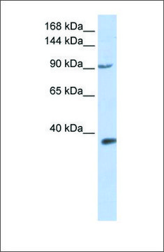 抗-EPAS1 兔抗 affinity isolated antibody