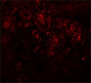Anti-PIAS1 antibody produced in rabbit affinity isolated antibody, buffered aqueous solution