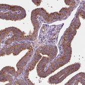 Anti-WARS2 antibody produced in rabbit Prestige Antibodies® Powered by Atlas Antibodies, affinity isolated antibody