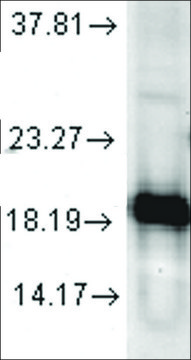 Anti-SOD1 antibody produced in rabbit 1&#160;mg/mL, affinity isolated antibody