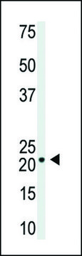 ANTI-VILIP1(C-TERMINAL) antibody produced in rabbit IgG fraction of antiserum, buffered aqueous solution