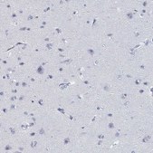 Anti-CD79B antibody produced in rabbit Prestige Antibodies® Powered by Atlas Antibodies, affinity isolated antibody, buffered aqueous glycerol solution