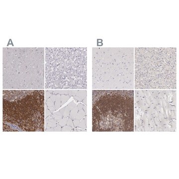 Anti-ARHGAP4 antibody produced in rabbit Ab1, Prestige Antibodies&#174; Powered by Atlas Antibodies, affinity isolated antibody, buffered aqueous glycerol solution