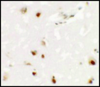 Anti-SHANK3 antibody produced in rabbit affinity isolated antibody, buffered aqueous solution