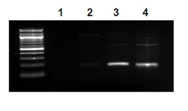 EZ-Magna ChIP&#174; A -染色质免疫沉淀试剂盒 Single day chromatin immunoprecipitation (ChIP) kit containing all necessary reagents to perform 22 individual chromatin immunoprecipitation (ChIP) reactions using magnetic A beads. Control primers included.